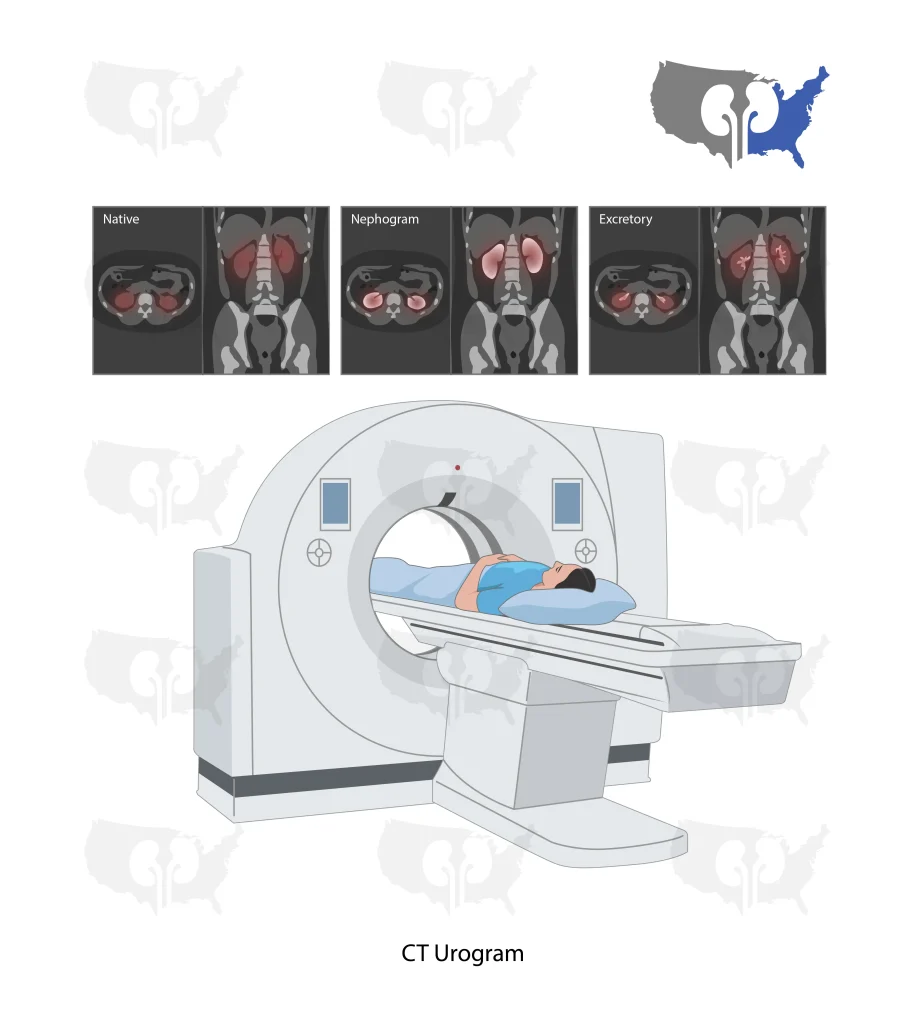 CT Urogram - Cross Roadsurology